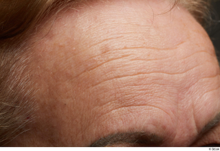 HD Face Skin Alma Escribano forehead skin texture wrinkles 0001.jpg